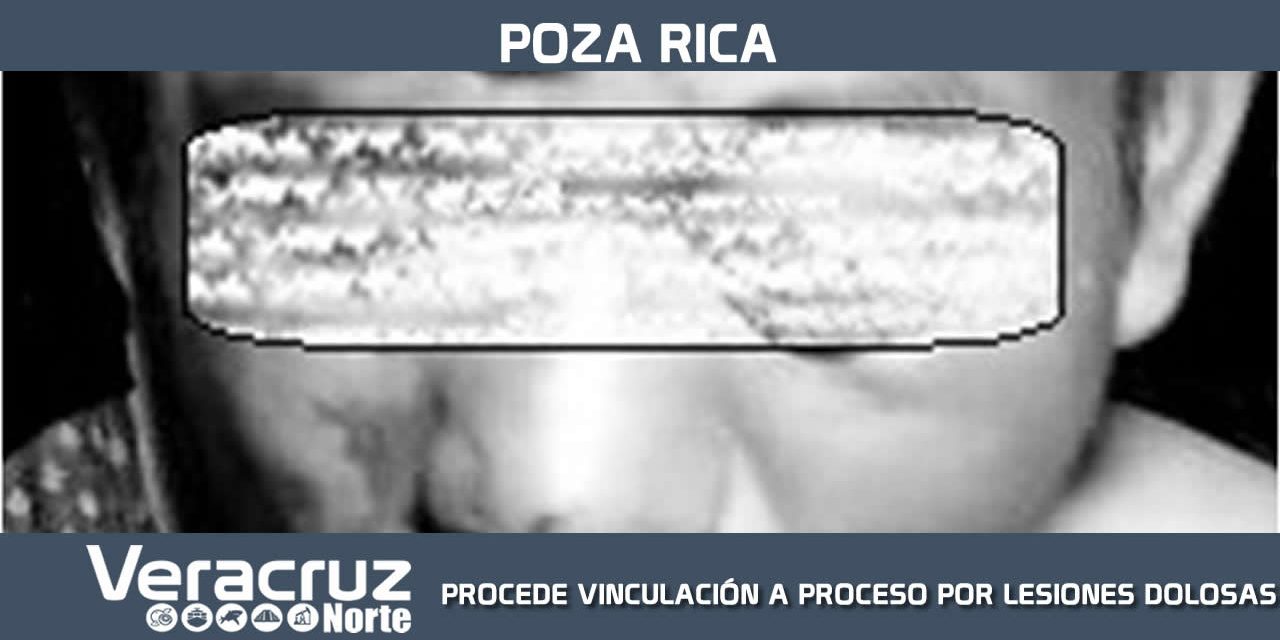 PROCEDE VINCULACIÓN A PROCESO POR LESIONES DOLOSAS CALIFICADAS