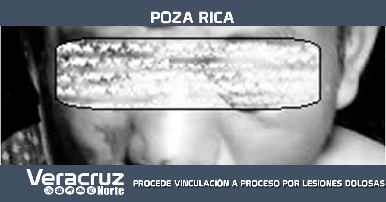 PROCEDE VINCULACIÓN A PROCESO POR LESIONES DOLOSAS CALIFICADAS