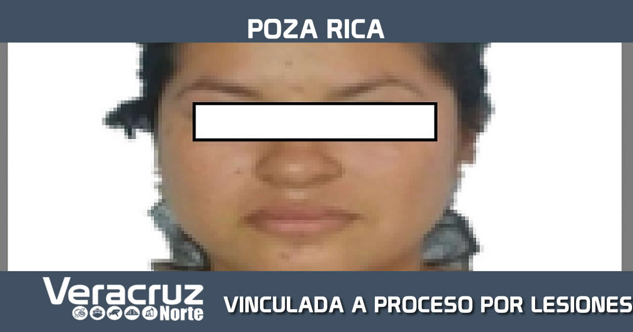 VINCULADA A PROCESO POR LESIONES