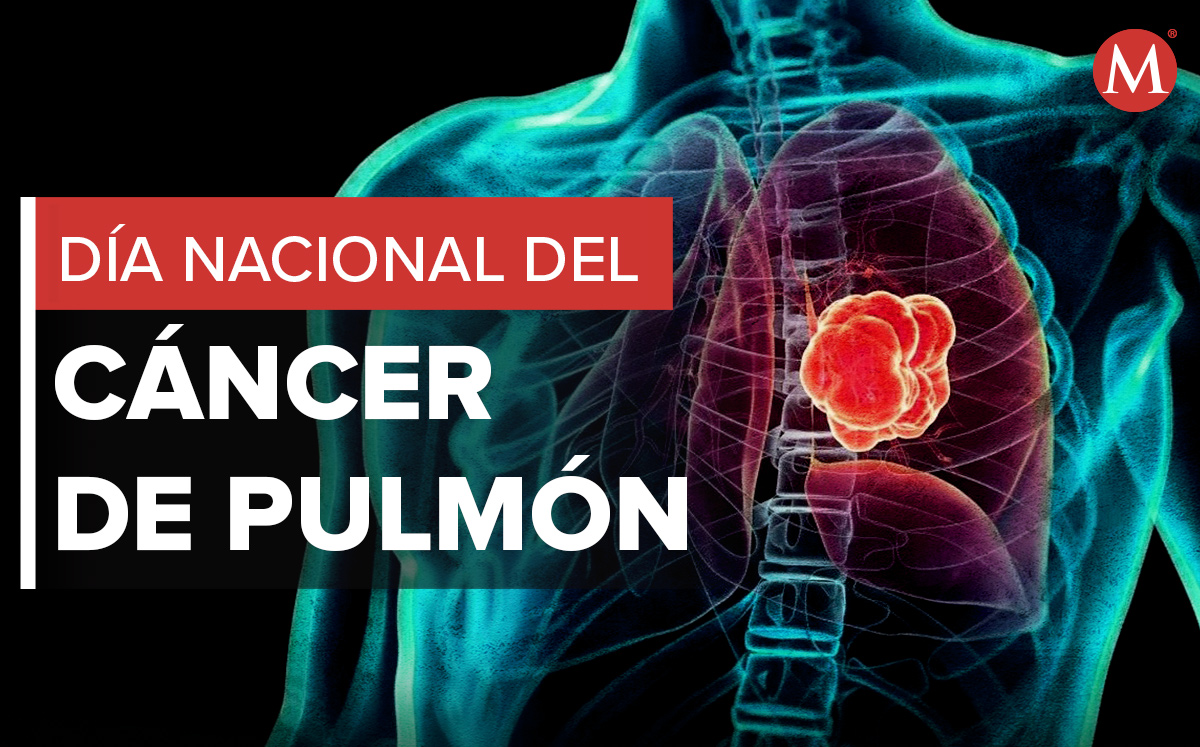 Gutiérrez Zamora: Día Nacional contra el Cáncer de Pulmón