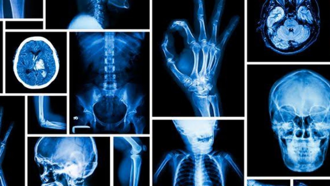 Naranjos: Día Nacional de la Radiología