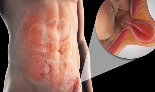 Mecatlán: Cirugías de Hernia y Vesícula