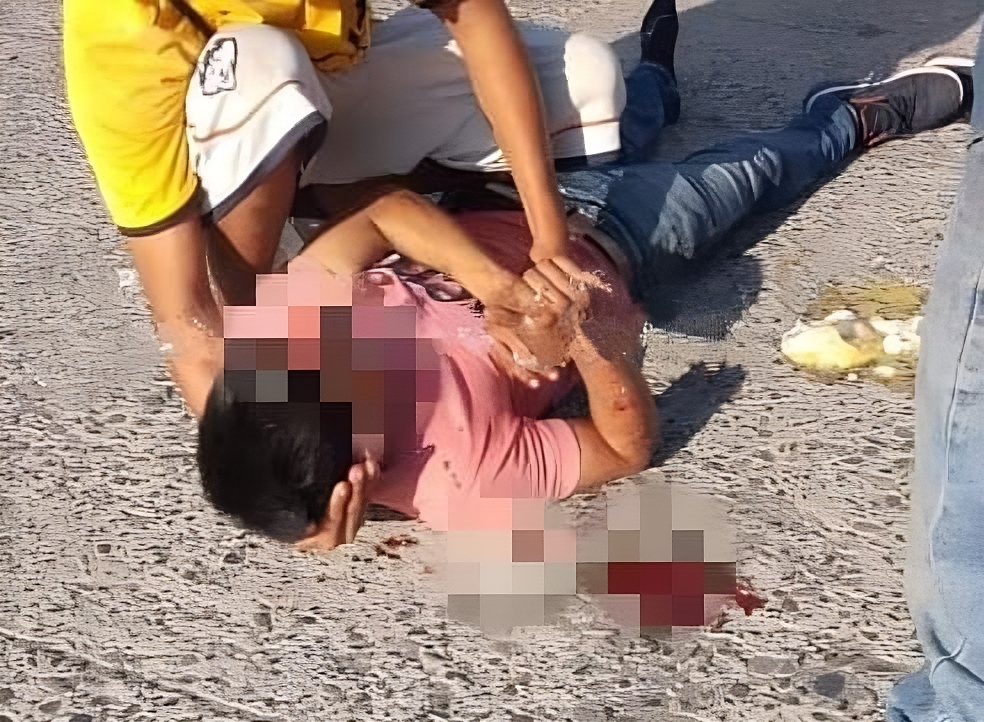 Álamo: «El Dudo» Termina en el Hospital Después de Atropellar a un Ciclista