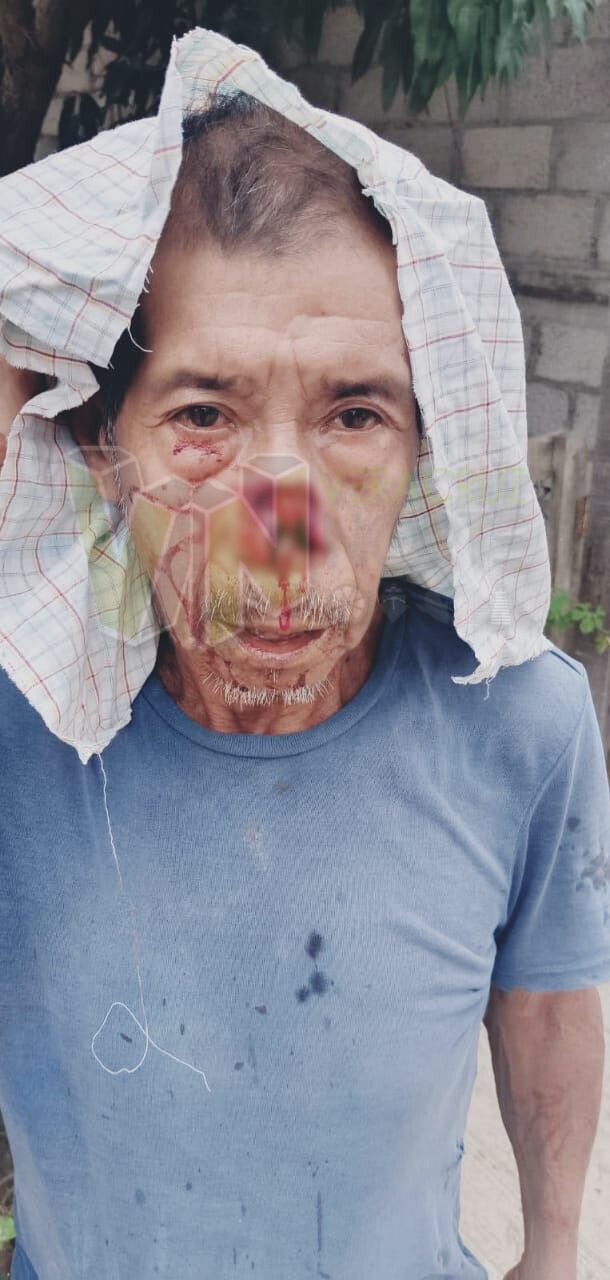 hijo cercena nariz en Álamo