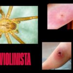 El Dato del Día: ¿Sabes identificar a la araña violinista?