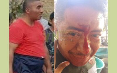 Álamo: Hombre con problemas mentales hiere a un vecino en  Exhacienda Alazán