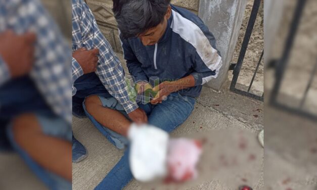 Evita un choque y termina en grave lesión en Álamo: Joven derrapa y sufre desgarro en el pie